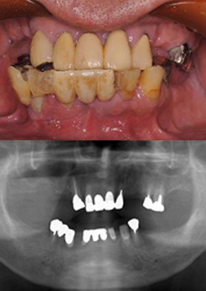 all on 4②治療前