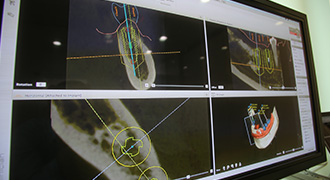 歯科用CTで的確な診断