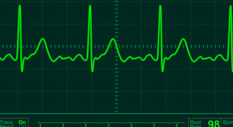 生体モニターで身体状態を管理