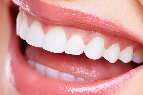 ホワイトニングとは